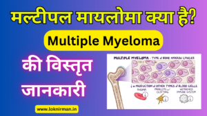 What Is Multiple Myeloma