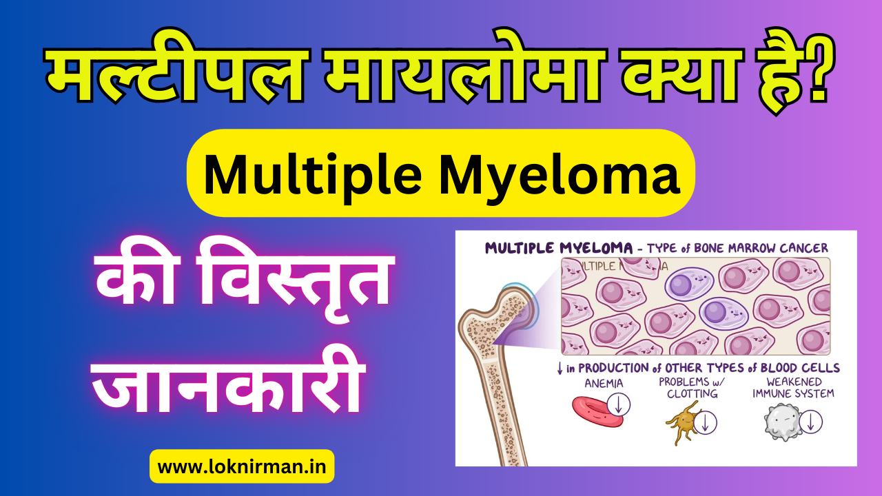 What Is Multiple Myeloma
